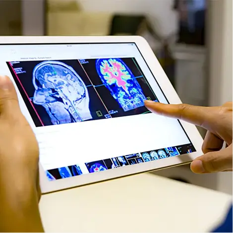 Person pointing at colorful brain scan images displayed on a tablet screen.
